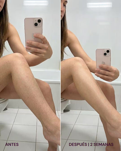 SkinPro®